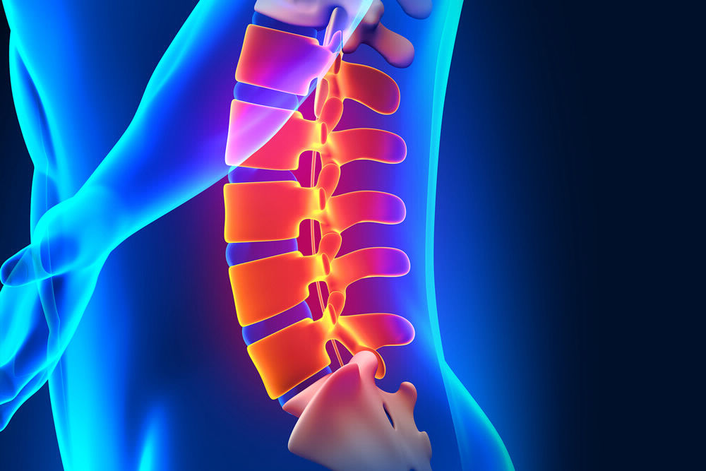Neurosurgery Arthritis (Spine) And Bone Spurs