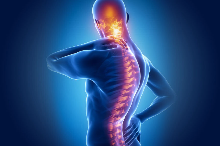 Back Pain