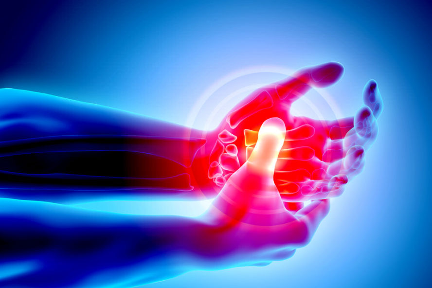 Carpal Tunnel