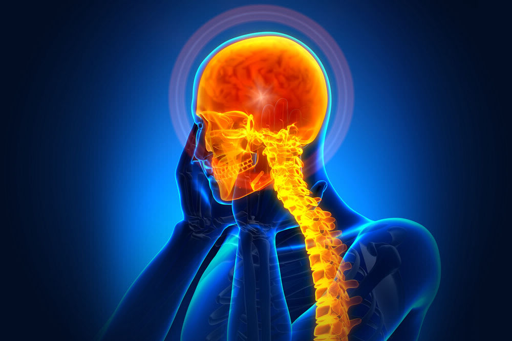 Neurosurgery Concussions