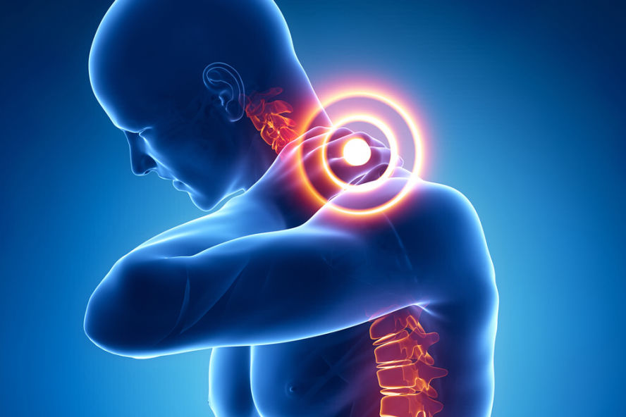 Neck Pain