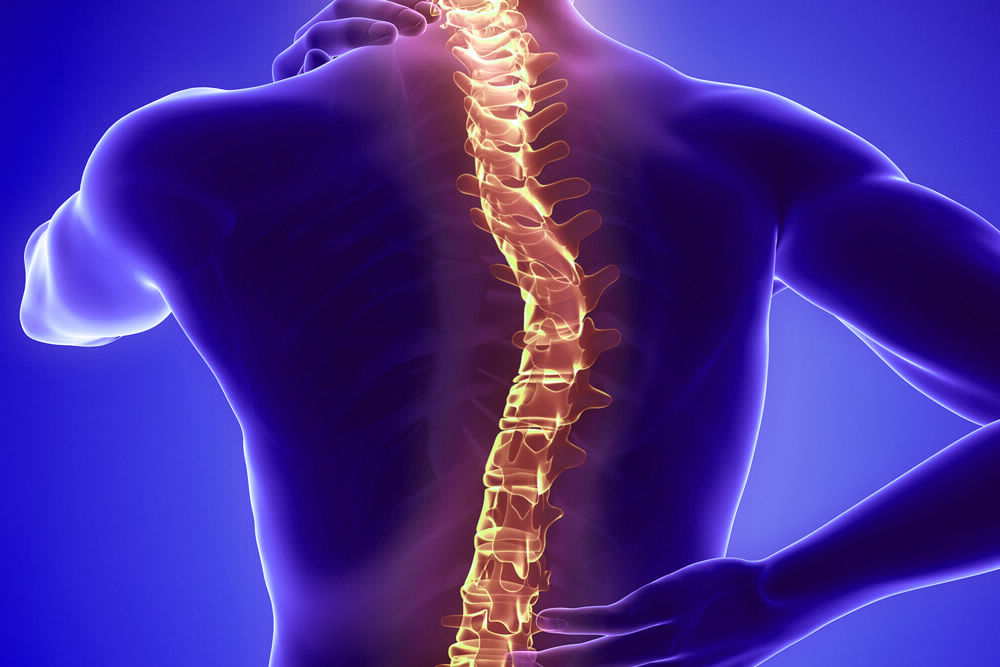 Neurosurgery Scoliosis