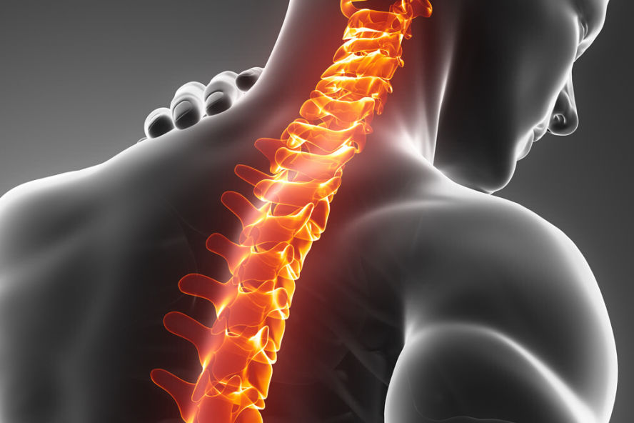 Spinal Stenosis